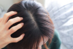 健康な頭皮