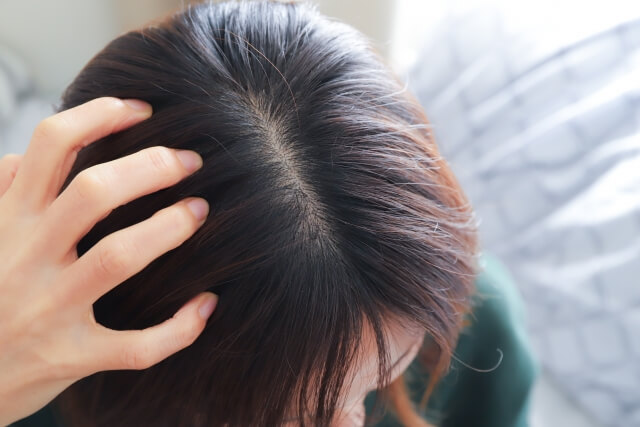 健康な頭皮